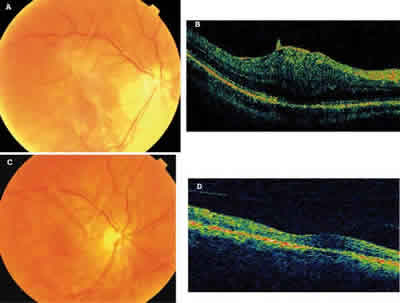 MACULA 8