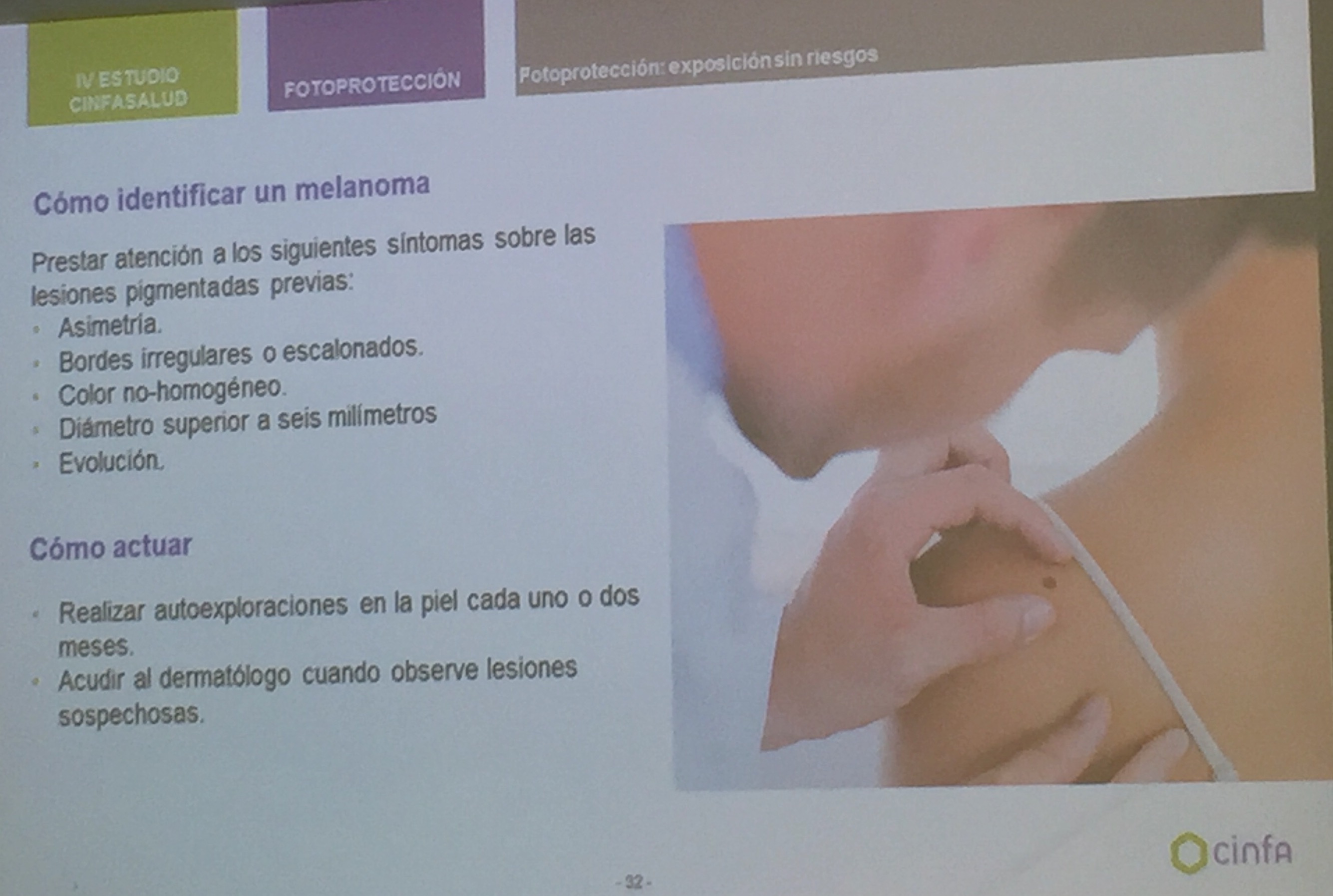 Como identificar el melanoma Saludentuvida.com