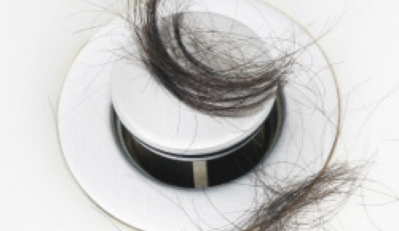 caida_cabello_alopecia_101