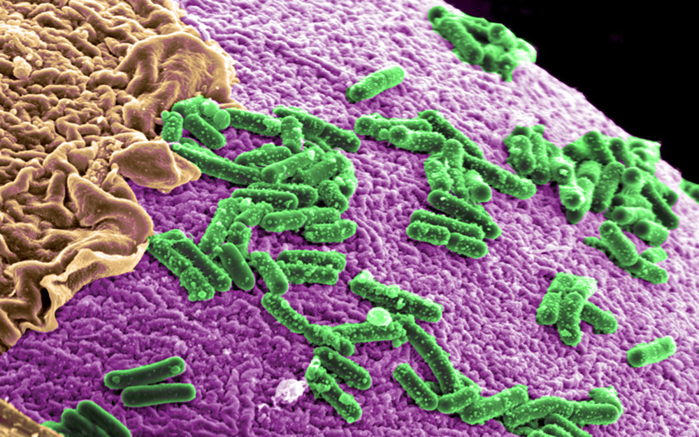 microbiota_intestinal_portada_27022016_saludigital2