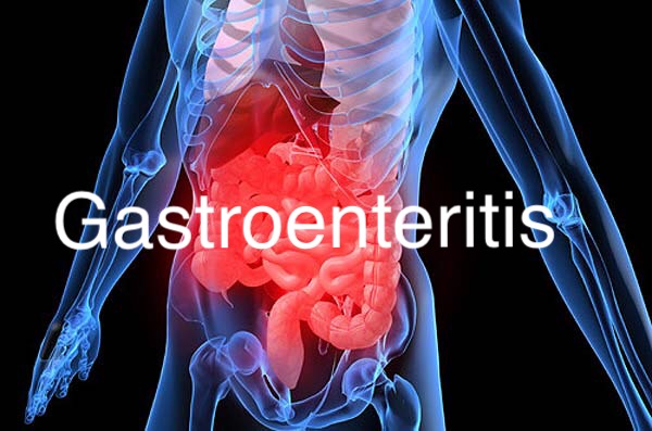 Gastroenteritis Saludentuvida.com